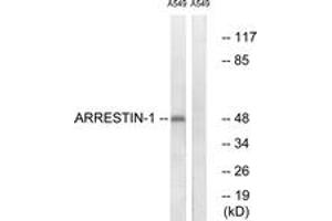 Image no. 3 for anti-Arrestin, beta 1 (ARRB1) (AA 369-418) antibody (ABIN2888645)