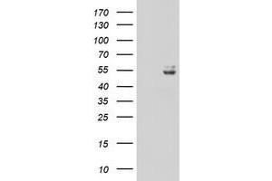 Image no. 1 for anti-Ubiquinol-Cytochrome C Reductase Core Protein I (UQCRC1) (AA 46-305) antibody (ABIN1491532)