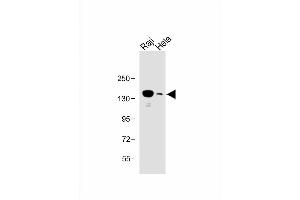 Image no. 3 for anti-Ubiquitin Conjugation Factor E4 B (UBE4B) (AA 112-142), (N-Term) antibody (ABIN388841)