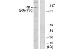 Image no. 1 for anti-Retinoblastoma Protein (Rb Protein) (AA 751-800), (pSer780) antibody (ABIN1531960)