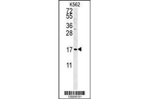 Image no. 3 for anti-Small Cell Adhesion Glycoprotein (SMAGP) (AA 46-75) antibody (ABIN651464)