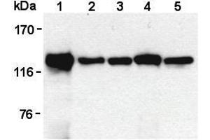 Image no. 2 for anti-Signal-Induced Proliferation-Associated 1 (SIPA1) antibody (ABIN1449259)