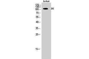 Image no. 1 for anti-TAO Kinase 3 (TAOK3) (Internal Region) antibody (ABIN3185262)