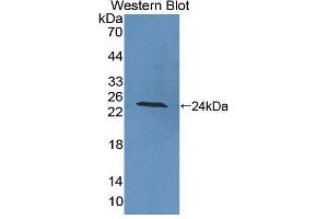 Image no. 1 for anti-Protein tyrosine Phosphatase, Receptor Type, A (PTPRA) (AA 618-796) antibody (ABIN5014195)