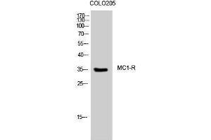 Image no. 1 for anti-Melanocortin 1 Receptor (MC1R) (C-Term) antibody (ABIN3185484)