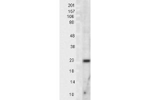 Image no. 2 for anti-Superoxide Dismutase 2, Mitochondrial (SOD2) antibody (Biotin) (ABIN2484764)