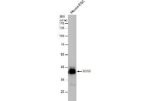 Image no. 10 for anti-SRY (Sex Determining Region Y)-Box 2 (SOX2) (Center) antibody (ABIN2855074)