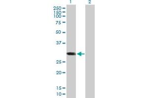 Image no. 1 for anti-ATP-Binding Cassette, Sub-Family C (CFTR/MRP), Member 10 (ABCC10) (AA 1-282) antibody (ABIN529931)