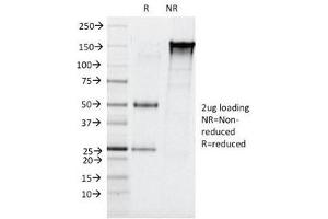 Image no. 2 for anti-Elastase 3B, Pancreatic (ELA3B) (AA 82-238) antibody (ABIN4949400)