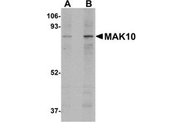 anti-MAK10 Homolog, Amino-Acid N-Acetyltransferase Subunit (MAK10) (Middle Region) antibody