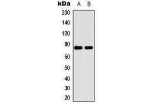 Image no. 1 for anti-Kin of IRRE Like 2 (Drosophila) (KIRREL2) (N-Term) antibody (ABIN2707510)
