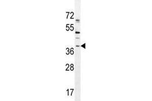 Image no. 2 for anti-SRY (Sex Determining Region Y)-Box 1 (SOX1) (AA 47-76) antibody (ABIN3032720)