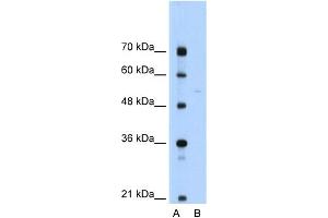 Image no. 1 for anti-Src-Like-Adaptor (SLA) (N-Term) antibody (ABIN2776658)