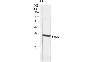 Image no. 2 for anti-serine/arginine-Rich Splicing Factor 3 (SRSF3) (C-Term) antibody (ABIN3187055)