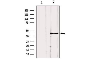 Image no. 2 for anti-Guanine Nucleotide Binding Protein (G Protein), alpha 11 (Gq Class) (GNA11) (Internal Region) antibody (ABIN6262007)