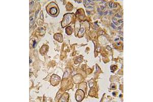 Image no. 1 for anti-Toll-Like Receptor 6 (TLR6) (C-Term) antibody (ABIN357055)