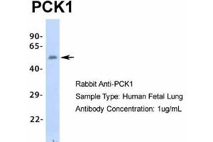 Image no. 2 for anti-phosphoenolpyruvate Carboxykinase 1 (Soluble) (PCK1) (Middle Region) antibody (ABIN2777603)