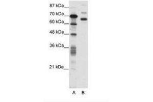 Image no. 1 for anti-CCCTC-Binding Factor (Zinc Finger Protein)-Like (CTCFL) (AA 211-260) antibody (ABIN6736093)