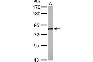 Image no. 1 for anti-DEAD (Asp-Glu-Ala-Asp) Box Polypeptide 3, X-Linked (DDX3X) (Center) antibody (ABIN2856700)