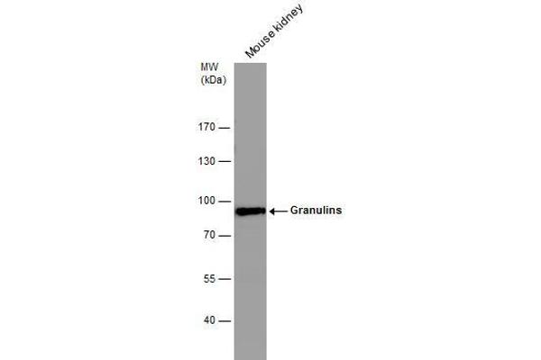 anti-Granulin (GRN) (Center) antibody