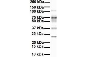 Image no. 2 for anti-Fatty Acid Transport Protein 3 (FATP3) (Middle Region) antibody (ABIN2781683)