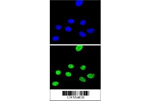 Image no. 2 for anti-X-Ray Repair Complementing Defective Repair in Chinese Hamster Cells 1 (XRCC1) (Center) antibody (ABIN2494219)
