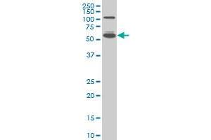 Image no. 2 for anti-Interferon Regulatory Factor 5 (IRF5) (AA 395-504) antibody (ABIN517230)