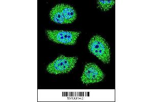 Image no. 3 for anti-P21-Activated Kinase 6 (PAK6) (AA 268-297) antibody (ABIN656098)