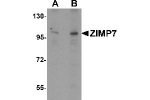 Western blot analysis of ZIMP7 in A20 cell lysate with ZIMP7 antibody at (A) 0.