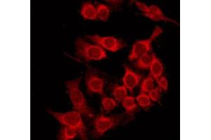 Image no. 2 for anti-MHC, Class I antibody (ABIN6263246)