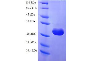 Image no. 1 for tRNA Methyltransferase 11-2 (TRMT112) (AA 1-125), (full length) protein (His-SUMO Tag) (ABIN5711901)