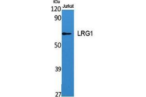 Image no. 2 for anti-Leucine-Rich alpha-2 Glycoprotein 1 (LRG1) (C-Term) antibody (ABIN3185409)