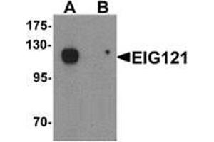Image no. 2 for anti-Endosome/Lysosome-associated Apoptosis and Autophagy Regulator 1 (ELAPOR1) (C-Term) antibody (ABIN1450044)