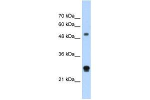 Image no. 2 for anti-Inhibin Binding Protein (INHBP) (N-Term) antibody (ABIN630244)