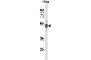 Image no. 1 for anti-CAMP Responsive Element Binding Protein 3-Like 2 (CREB3L2) (AA 491-520), (C-Term) antibody (ABIN951696)