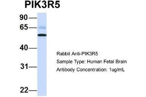 Image no. 2 for anti-Phosphoinositide-3-Kinase, Regulatory Subunit 5 (PIK3R5) (N-Term) antibody (ABIN2786003)