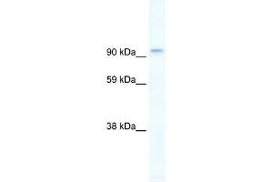 Image no. 1 for anti-Phosphoinositide-3-Kinase, Catalytic, beta Polypeptide (PIK3CB) (C-Term) antibody (ABIN630206)