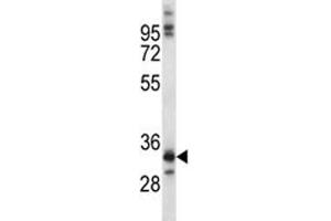 Image no. 2 for anti-NK6 Homeobox 1 (NKX6-1) (AA 284-312) antibody (ABIN3028876)