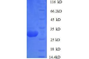 Cathepsin K (CTSK) (AA 115-329) protein (His tag) expressed in E.