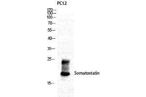 Image no. 2 for anti-Somatostatin (SST) (N-Term) antibody (ABIN3187021)
