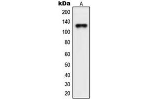 Image no. 2 for anti-serologically Defined Colon Cancer Antigen 1 (SDCCAG1) (C-Term) antibody (ABIN2705030)