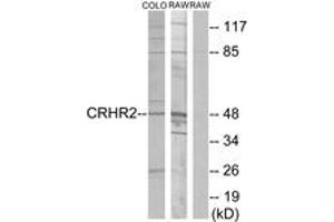 Image no. 1 for anti-Corticotropin Releasing Hormone Receptor 2 (CRHR2) (AA 71-120) antibody (ABIN1535581)
