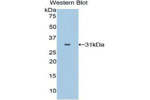 Image no. 1 for anti-GRB2-Related Adaptor Protein 2 (GRAP2) (AA 15-247) antibody (ABIN1859063)