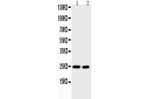 Image no. 1 for anti-Interleukin 6 (IL6) (AA 25-211) antibody (ABIN3043248)