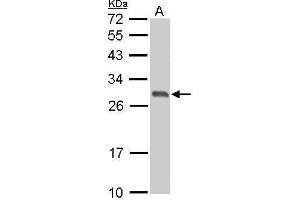 WB Image 14-3-3 sigma antibody detects SFN protein by Western blot analysis.