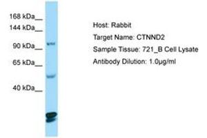 Image no. 1 for anti-Catenin (Cadherin-Associated Protein), delta 2 (Neural Plakophilin-Related Arm-Repeat Protein (CTNND2) (AA 1066-1115) antibody (ABIN6749992)