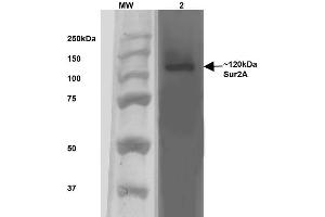 Image no. 2 for anti-ATP-Binding Cassette, Sub-Family C (CFTR/MRP), Member 9 (ABCC9) (AA 1505-1546) antibody (HRP) (ABIN2482980)