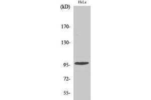 Western Blot analysis of Hela cells using Phospho-CHEK2 (Thr68) Polyclonal Antibody at dilution of 1:500