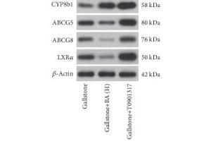 Image no. 1 for anti-ATP-Binding Cassette, Sub-Family G (WHITE), Member 8 (ABCG8) antibody (ABIN3022643)