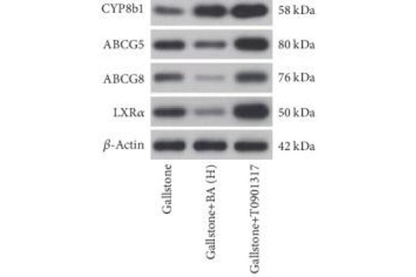anti-ATP-Binding Cassette, Sub-Family G (WHITE), Member 8 (ABCG8) antibody